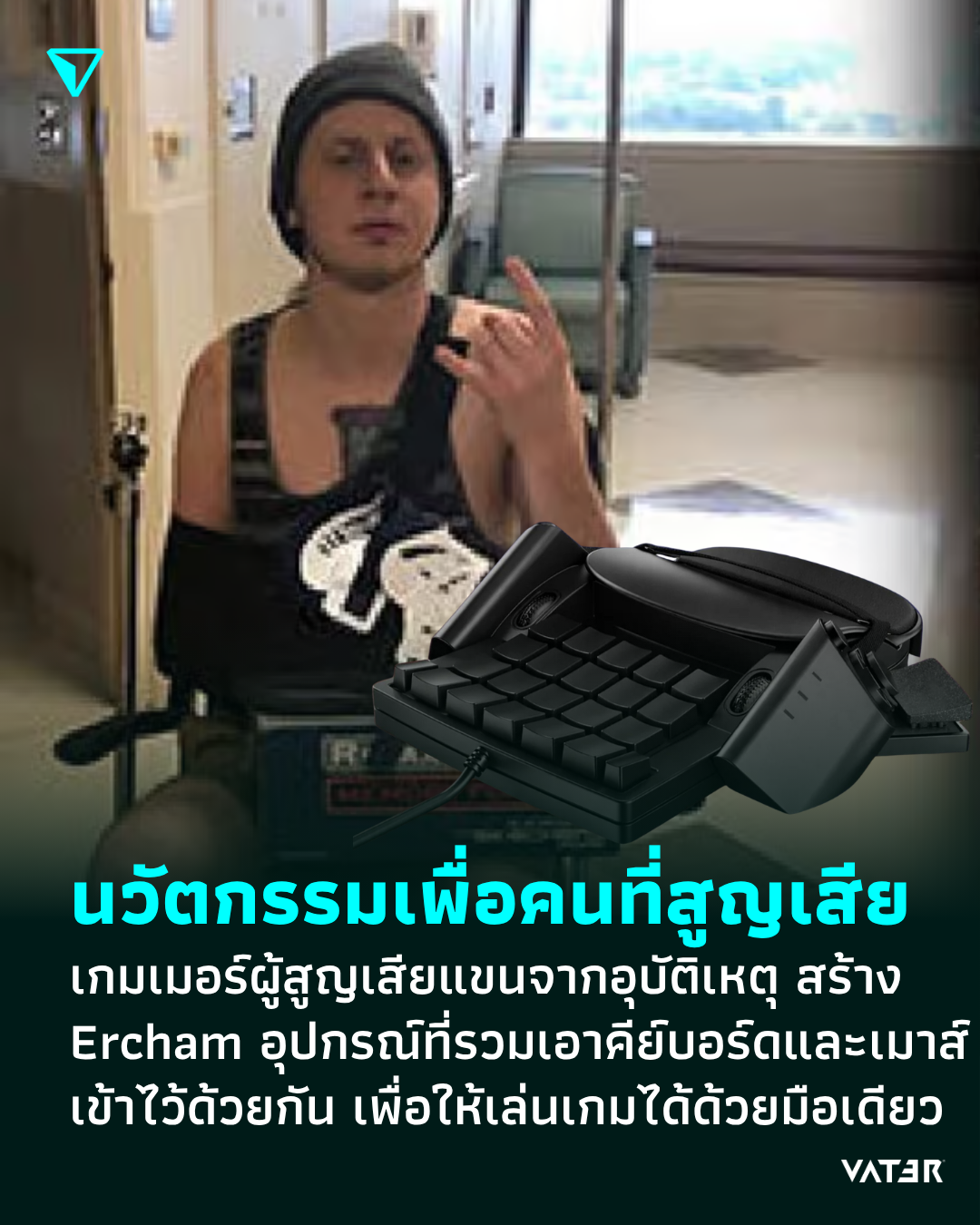 ภาพประกอบข่าว นวัตกรรมเพื่อคนที่สูญเสีย เกมเมอร์ผู้สูญเสียแขนจากอุบัติเหตุ สร้าง Ercham อุปกรณ์ที่รวมเอาคีย์บอร์ดและเมาส์เข้าไว้ด้วยกัน เพื่อให้เล่นเกมได้ด้วยมือเดียว