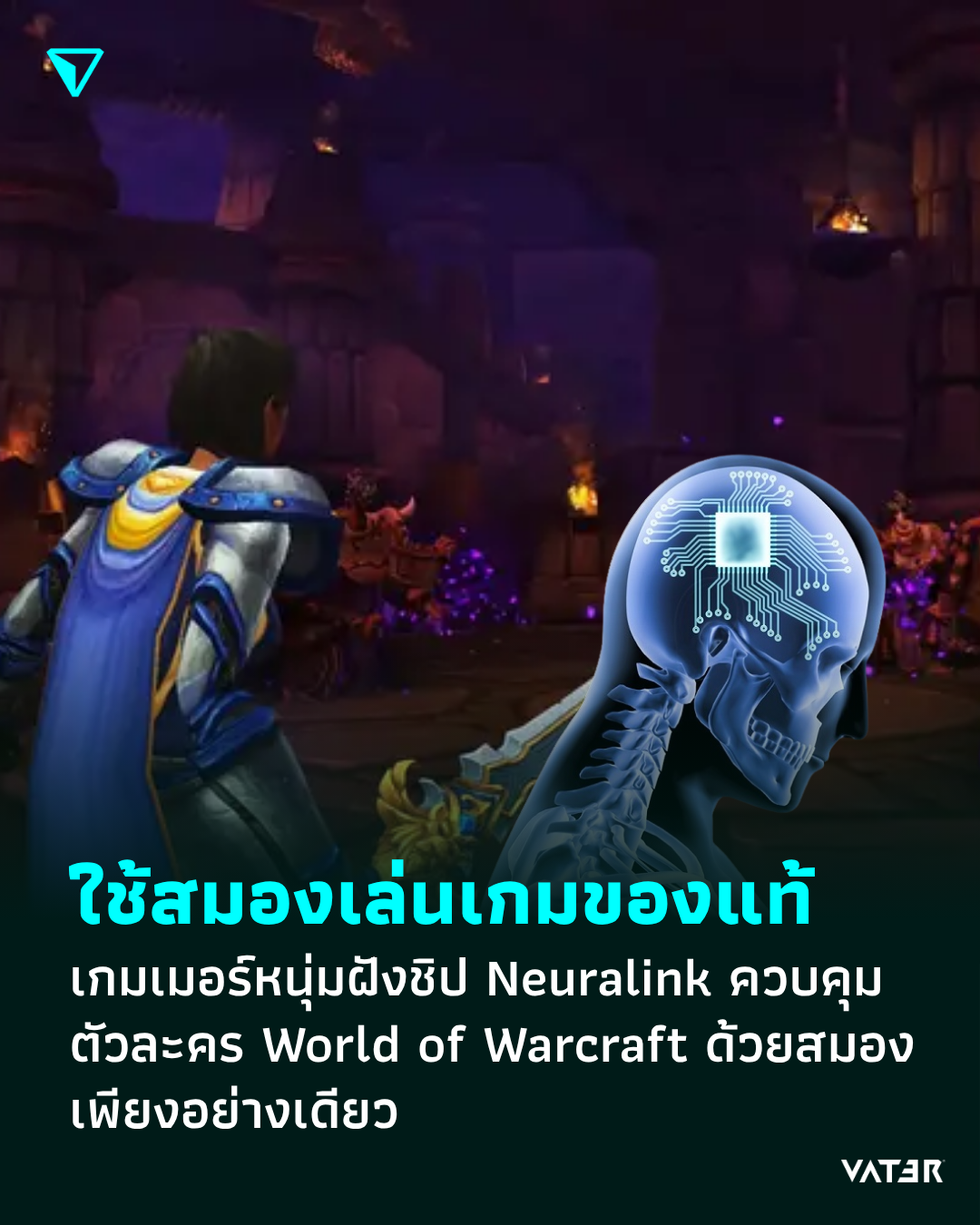 ภาพประกอบข่าว ใช้สมองเล่นเกมของแท้ เกมเมอร์หนุ่มฝังชิป Neuralink ควบคุมตัวละคร World of Warcraft ด้วยสมองเพียงอย่างเดียว